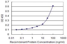 Anti-ITGB2 Mouse Monoclonal Antibody [clone: 3C7]