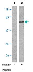 Anti-PAK1 Rabbit Polyclonal Antibody