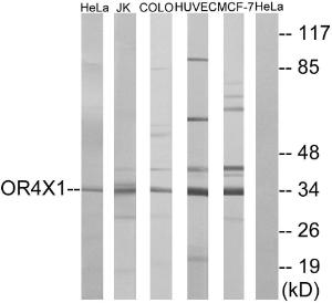 Anti-OR4X1 Rabbit Polyclonal Antibody