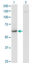 Anti-CDR2 Mouse Monoclonal Antibody [clone: 4D2]