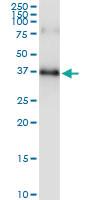 Anti-SPRY1 Rabbit Polyclonal Antibody