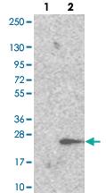 Anti-TRAPPC6A Rabbit Polyclonal Antibody