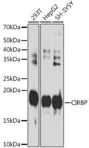 Anti-CIRP Rabbit Monoclonal Antibody [clone: ARC2472]