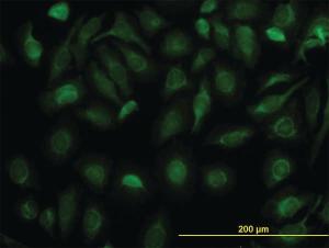 Anti-FH Mouse Monoclonal Antibody [clone: 5C12]