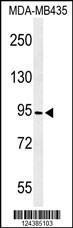 Anti-CF097 Rabbit Polyclonal Antibody (FITC (Fluorescein Isothiocyanate))