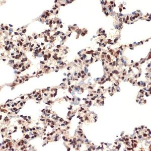 Anti-CIRP Rabbit Monoclonal Antibody [clone: ARC2472]