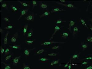 Anti-CDR2 Mouse Monoclonal Antibody [clone: 4D2]