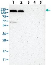 Anti-KIAA0355 Rabbit Polyclonal Antibody