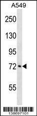 Anti-ATXN1L Rabbit Polyclonal Antibody (AP (Alkaline Phosphatase))