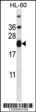 Anti-CD3E Rabbit Polyclonal Antibody (HRP (Horseradish Peroxidase))