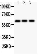 Anti-Perforin Polyclonal Antibody