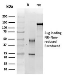 SDS-PAGE analysis of Anti-SNF5 Antibody [SMARCB1/3984] under non-reduced and reduced conditions; showing intact IgG and intact heavy and light chains, respectively. SDS-PAGE analysis confirms the integrity and purity of the antibody.