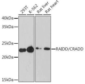 Western blot analysis of extracts of various cell lines, using Anti-RAIDD Antibody [ARC1771] (A305654) at 1:1000 dilution. The secondary Antibody was Goat Anti-Rabbit IgG H&L Antibody (HRP) at 1:10000 dilution.nced Kit (RM00021). Exposure time: 3 min