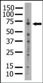 Anti-PRKCZ Rabbit Polyclonal Antibody