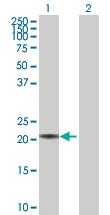 Anti-MED18 Mouse Polyclonal Antibody