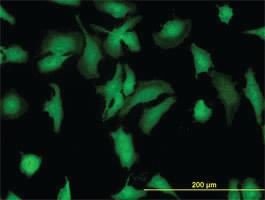 Anti-STIP1 Mouse Monoclonal Antibody [clone: 1E3]