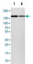 Anti-KIAA0355 Rabbit Polyclonal Antibody