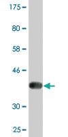 Anti-SPP1 Mouse Monoclonal Antibody [clone: 3C7]