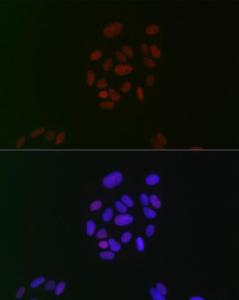 Anti-CIRP Rabbit Monoclonal Antibody [clone: ARC2472]