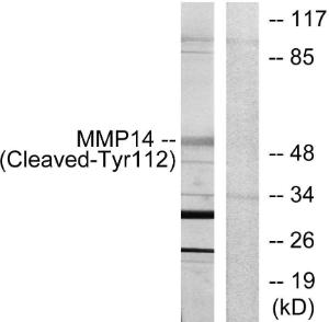 Western blot analysis of lysates from 293 cells, treated with etoposide 25uM 1h using Anti-MMP14 (cleaved Tyr112) Antibody. The right hand lane represents a negative control, where the antibody is blocked by the immunising peptide.