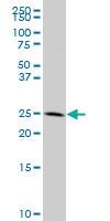 Anti-EIF6 Mouse Polyclonal Antibody