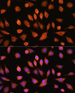 Anti-PI4KA antibody