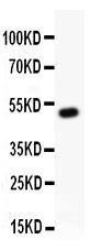 Anti-RUNX1/AML1 Polyclonal Antibody