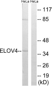 Western blot analysis of lysates from HeLa cells using Anti-ELOVL4 Antibody. The right hand lane represents a negative control, where the antibody is blocked by the immunising peptide.