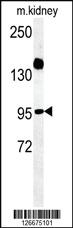 Anti-ARMC5 Rabbit Polyclonal Antibody