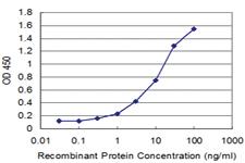 Anti-TCAP Mouse Monoclonal Antibody [clone: 1H3]