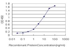 Anti-STIP1 Mouse Monoclonal Antibody [clone: 1E3]