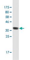 Anti-RAB3B Mouse Monoclonal Antibody [clone: 3F12]