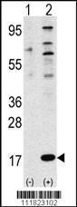 Anti-FAU Rabbit Polyclonal Antibody (APC (Allophycocyanin))