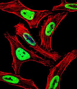 Anti-EWSR1 Rabbit Polyclonal Antibody (PE (Phycoerythrin))