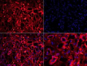 A00816 1 IHC P test on Human Kidney