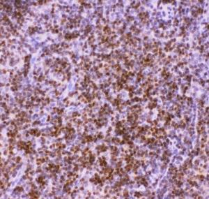 Anti-RUNX1/AML1 Polyclonal Antibody