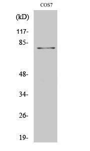 Anti-MRE11 antibody