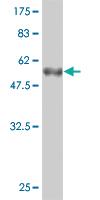 Anti-CRYBB1 Mouse Monoclonal Antibody [clone: 2B2]