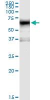 Anti-MAOA Polyclonal Antibody Pair