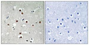 Immunohistochemical analysis of paraffin-embedded human brain using Anti-MEF2C (phospho Ser396) Antibody. The right hand panel represents a negative control, where the antibody was pre-incubated with the immunising peptide.