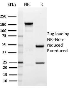 SDS-PAGE analysis of Anti-SIGLEC1 Antibody [HSn 7D2] under non-reduced and reduced conditions; showing intact IgG and intact heavy and light chains, respectively. SDS-PAGE analysis confirms the integrity and purity of the antibody