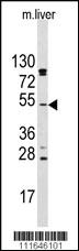 Anti-AKT2 Rabbit Polyclonal Antibody