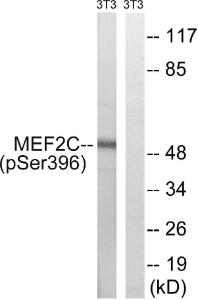 Western blot analysis of lysates from NIH/3T3 cells treated with starved 24h using Anti-MEF2C (phospho Ser396) Antibody. The right hand lane represents a negative control, where the antibody is blocked by the immunising peptide.