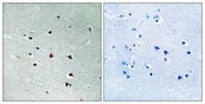 Anti-MRE11 antibody