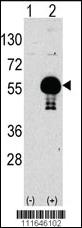 Anti-AKT2 Rabbit Polyclonal Antibody