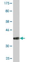 Anti-SPP1 Mouse Monoclonal Antibody [clone: 1D7]