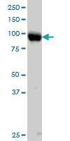 Anti-ITGB5 Mouse Monoclonal Antibody [clone: 2C4]