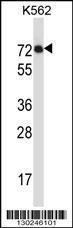 Anti-IL1RL2 Rabbit Polyclonal Antibody (HRP (Horseradish Peroxidase))