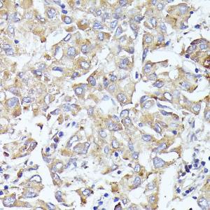 Anti-eIF3l antibody