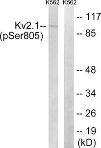 Western blot analysis of lysates from K562 cells treated with TNF 200 ng/ml 30' using Anti-Kv2.1 (phospho Ser805) Antibody. The right hand lane represents a negative control, where the antibody is blocked by the immunising peptide